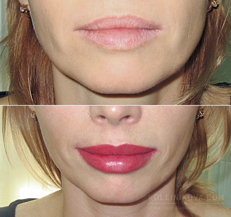 Контур губ до и после. Перманентный макияж губ. Перманентный макияж губ до и после. Перманент губ. Перманент губ до и после.